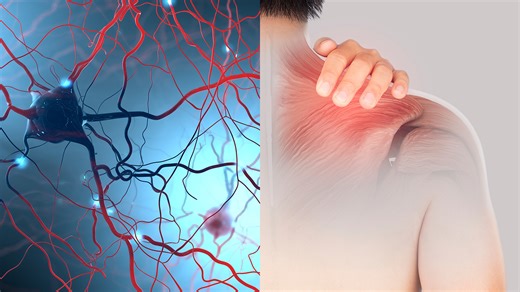 New Technology Can Reduce Pain Without Addictive Opioids