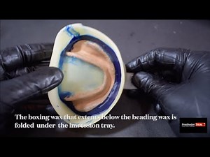 Beading and boxing of Mandibular complete denture impression | Easy step by step