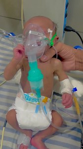 Baby Nebulization #baby #nebulization #therapy #cute #cutebaby | Sahib Ansari