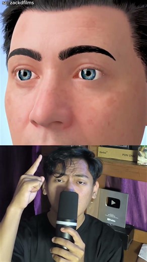 Niat ganti mata karna minus, malah jadi buta selamanya!! #sick #mata