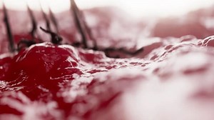 3d Animation Depicts Growth Malignant Cancer Stock Footage Video (100% Royalty-free) 3810754549 | Shutterstock