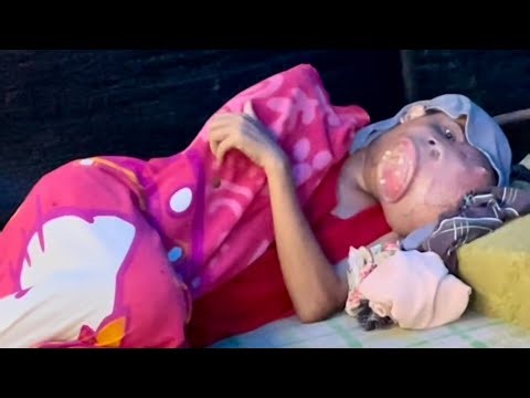 Gift for Sonny Boy & Update - Man with tumor on face - 🇵🇭