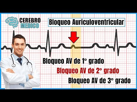 Atrioventricular Blocks (1st, 2nd, and 3rd AV Blocks) | ▷ How to Read an EKG Step by Step