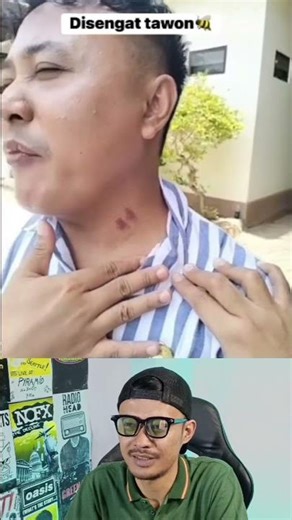 Cringe Is it true that his fangs were there? #shorts