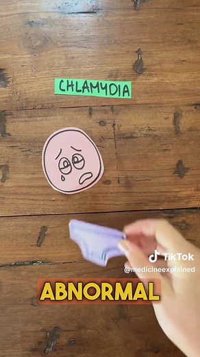 Understanding Chlamydia: Causes, Symptoms, and Treatment