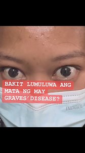 22K views · 227 reactions | GRAVES’ OPHTHALMOPATHY O THYROID EYE DISEASE- Anong sanhi nito? | Irma Antonio-Pilar MD/ Diabetes and Thyroid Specialist | Facebook