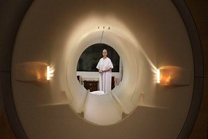 Radiotherapy may cause long-term cognitive impairment