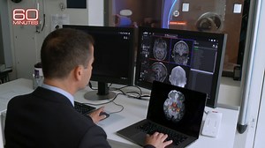 6.1K views · 84 reactions | A preliminary study on cumulative, low-level blasts found that the waves might penetrate the skull and reach the brain through the eyes. This could lead to a broad range of symptoms, from difficulty regulating emotions to disinhibition, says Harvard professor Dr. Brian Edlow. https://cbsn.ws/4iXqIoZ | 60 Minutes | Facebook