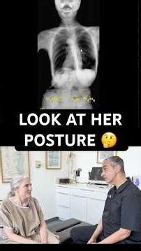 After 26 years with MS & Scoliosis…this happened after ONE visit ‪@DrRahim‬