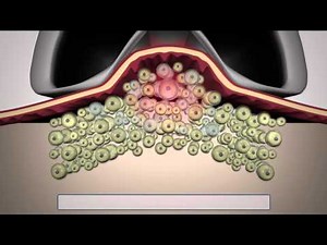 LipoContrast - The latest non-invasive fat freezing machine