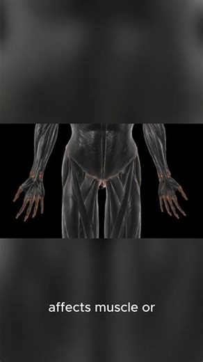 Fracture vs Sprain vs Tear | What’s the Difference?