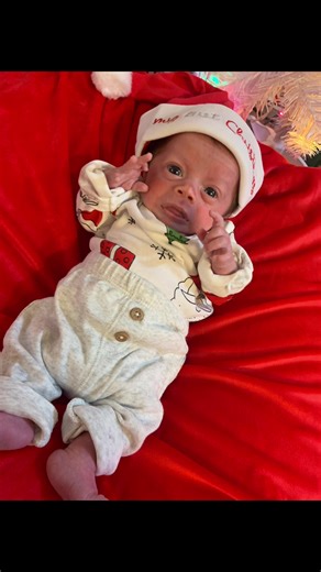 Adorable 18-Month-Old Baby with Dwarfism