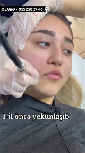 Üzdəki Sızanaqların Yerinə Görə Səbəblər #dermatoloq