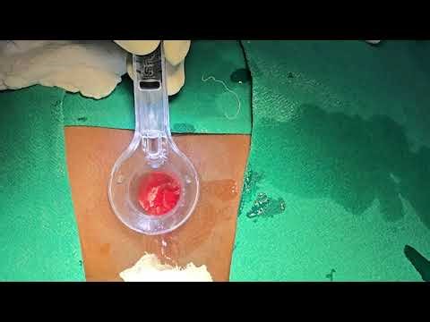 PROCTOSCOPY|DR.SACHIN GUPTA-+919419135050 #shorts #surgicaltraining #india