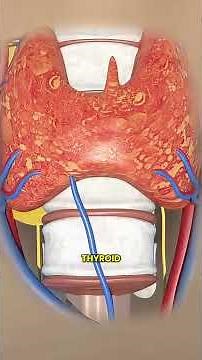 Can You Live Without a Thyroid? 🇱🇷 🤔 Total Thyroidectomy Explained