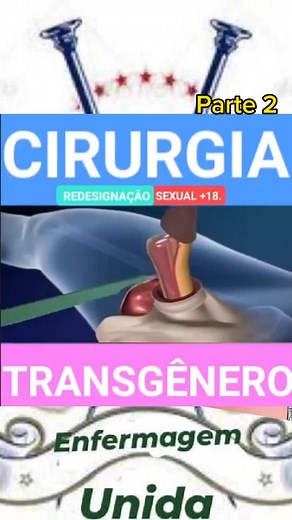 Cirugías de Reasignación de Género: Procesos y Resultados