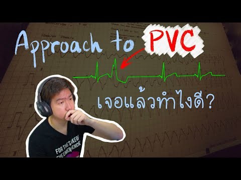 What to do if you encounter PVCs | Frontline EKG