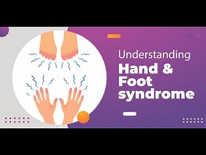 Hand foot syndrome or palmar plantar erythrodysesthesia ; Causes, Symptoms, Diagnosis, Treatment
