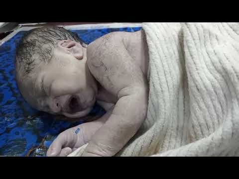 First Moments After Birth | Newborn Amniotic Fluid Removal |