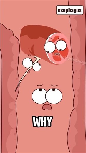 What happens when a fishbone gets stuck in your throat?#shorts #funny#hot