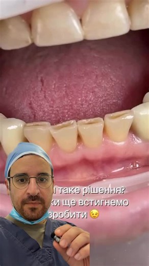 Dr Pan | Chirurgien Dentiste on Instagram: "Usure des bords incisifs : comprendre les causes pour mieux protéger les dents ! Vous vous êtes déjà demandé pourquoi les bords des dents de devant s’aplatissent, s’effritent ou se raccourcissent avec le temps L’usure des bords incisifs est un phénomène fréquent, souvent progressif et longtemps ignoré. Elle concerne principalement les dents antérieures et peut avoir un impact à la fois fonctionnel, esthétique et structurel. Cette usure n’est jamais due