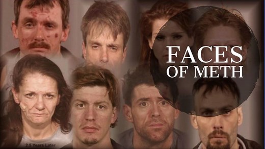 How methamphetamine destroys your face and physical appearance