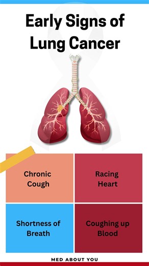 Early Signs of Lung Cancer 🫁 You Should Never Ignore |Lung Health Awareness #lungcancer #lungtumor