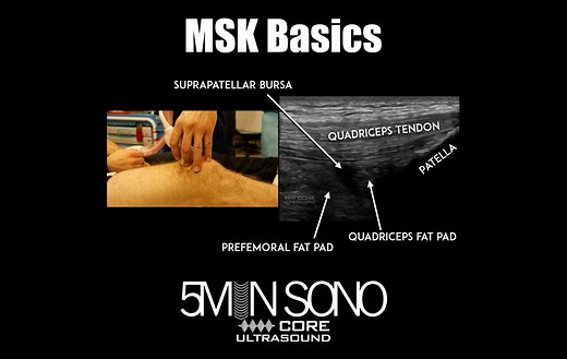 Five Minute Sono – MSK Basics - Core Ultrasound
