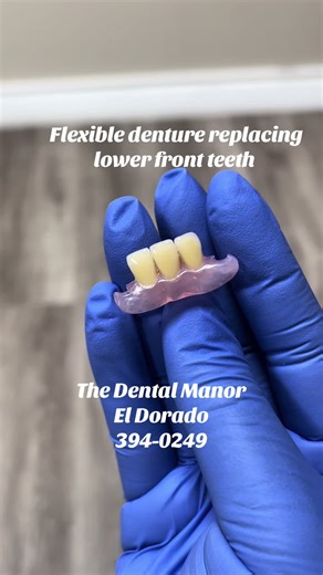 Valplast flexible dentures are highly aesthetic with no metal clasps, making them perfectly discreet for front tooth replacement. For further information contact us at 394-0249 #trinidaddentist #dentures