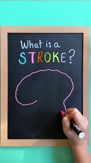 Understanding Different Stroke Types for Nursing Students