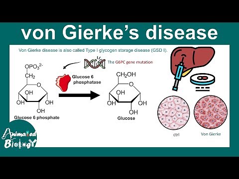 Von Gierke disease | Type I glycogen storage disease (GSD I) | Glycogen metabolism