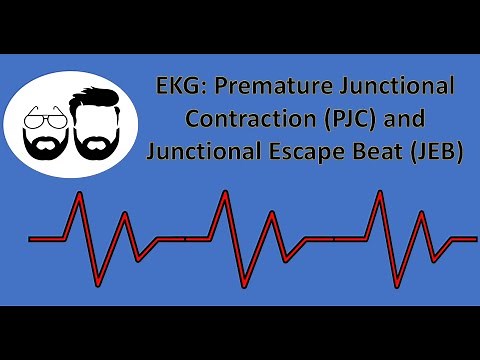 EKG Series: Premature Junctional Contraction (PJC) and Junctional Escape Beat (JEB)