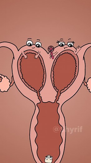 Why Some Women Still Bleed After Getting Pregnant #animation #funny | Shyrif