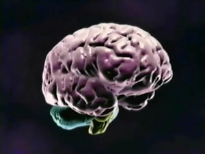 Alcoholism as a Brain-Based Disorder