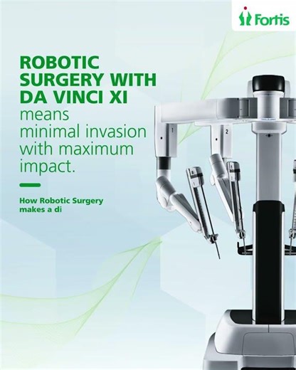 Da Vinci Xi Robotic Surgery: Precision, Safety & Faster Recovery Explained