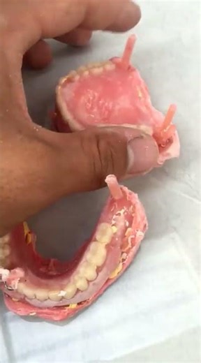 The surprisingly detailed process of denture creation #dental #satisfying