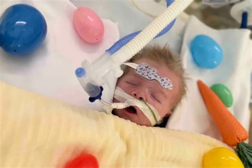 Botched circumcision leaves Long Island infant fighting to live, dad says