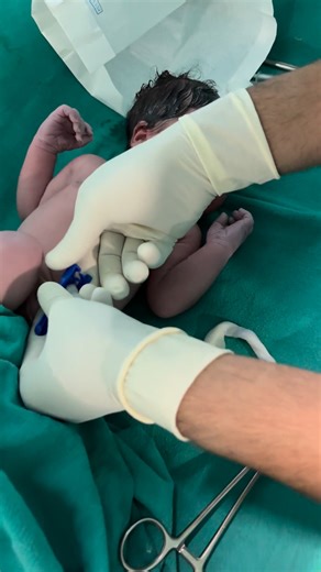 27K views · 414 reactions | At birth newborn baby removed to umbilical and code clamp and cute baby #niculife #prematurebirth #nicubaby #Babycare #prematurebaby #cutebaby #fblifestyle #atbirth #newborn | Little Angel Care | Facebook