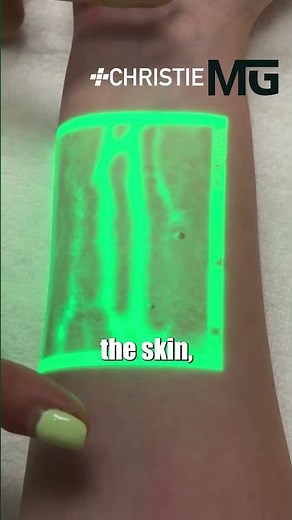 Is This The Future of Vein Detection?? 🤯🤯