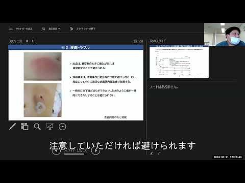 進行期パーキンソン病に対する新治療法 ヴィアレブ持続皮下投与システム