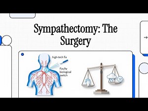 193 Sympathectomy The Surgery