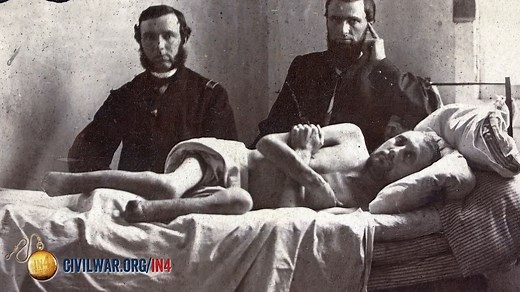 Understanding Civil War Medicine | Britannica