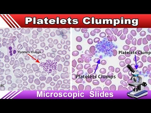 Platelets Clumping ( Increase Your Identification Skills )