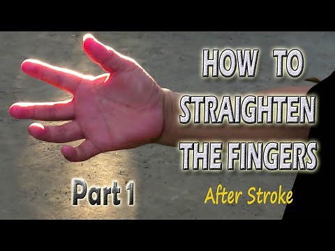 HOW TO STRAIGHTEN THE FINGERS After Stroke Part 1