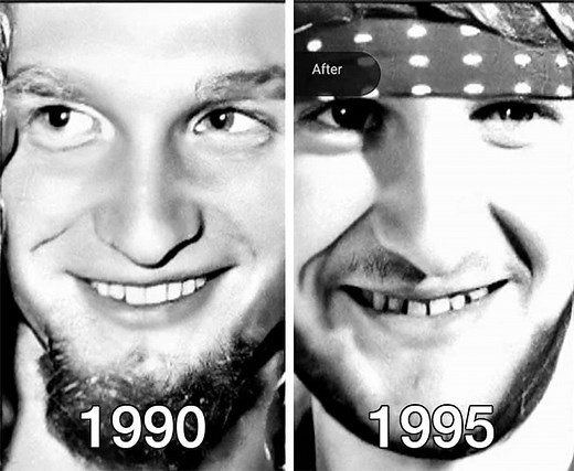What Happened To Layne Staley's Teeth? - Ned Hardy
