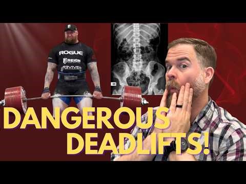 Are deadlifts actually that dangerous?