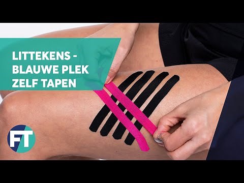 Het zelf tapen van littekens en blauwe plekken » Instructie » FysioTape