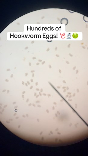 🔬 Worms… LOTS of worms. 😳 This poor puppy’s fecal sample was crawling with hookworm eggs — plus a few roundworm and coccidia eggs for good measure. Parasites = diarrhea, weight loss, bloating, and a very unhappy pup. They can be picked up from soil, water, food, prey, or even passed from mom to baby. 💡 Pro tip: Fecal testing every 6 months helps us catch these pests before they cause trouble! | Heartland Veterinary Hospital