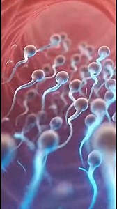 1.6M views · 2.5K reactions | How the copper IUD works inside the Body #healthylifestyle #healthcare #ConceptionTips #fblifestyle | BodyLogic 3D | Facebook