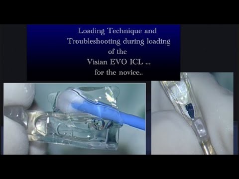 Visian EVO ICL loading and troubleshooting situations while loading .. for the novice.